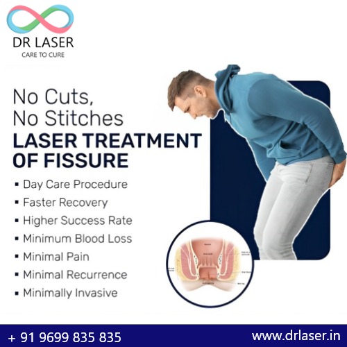 Why Laser Treatment for Fissures is the Best Choice: A Guide by Dr. Laser