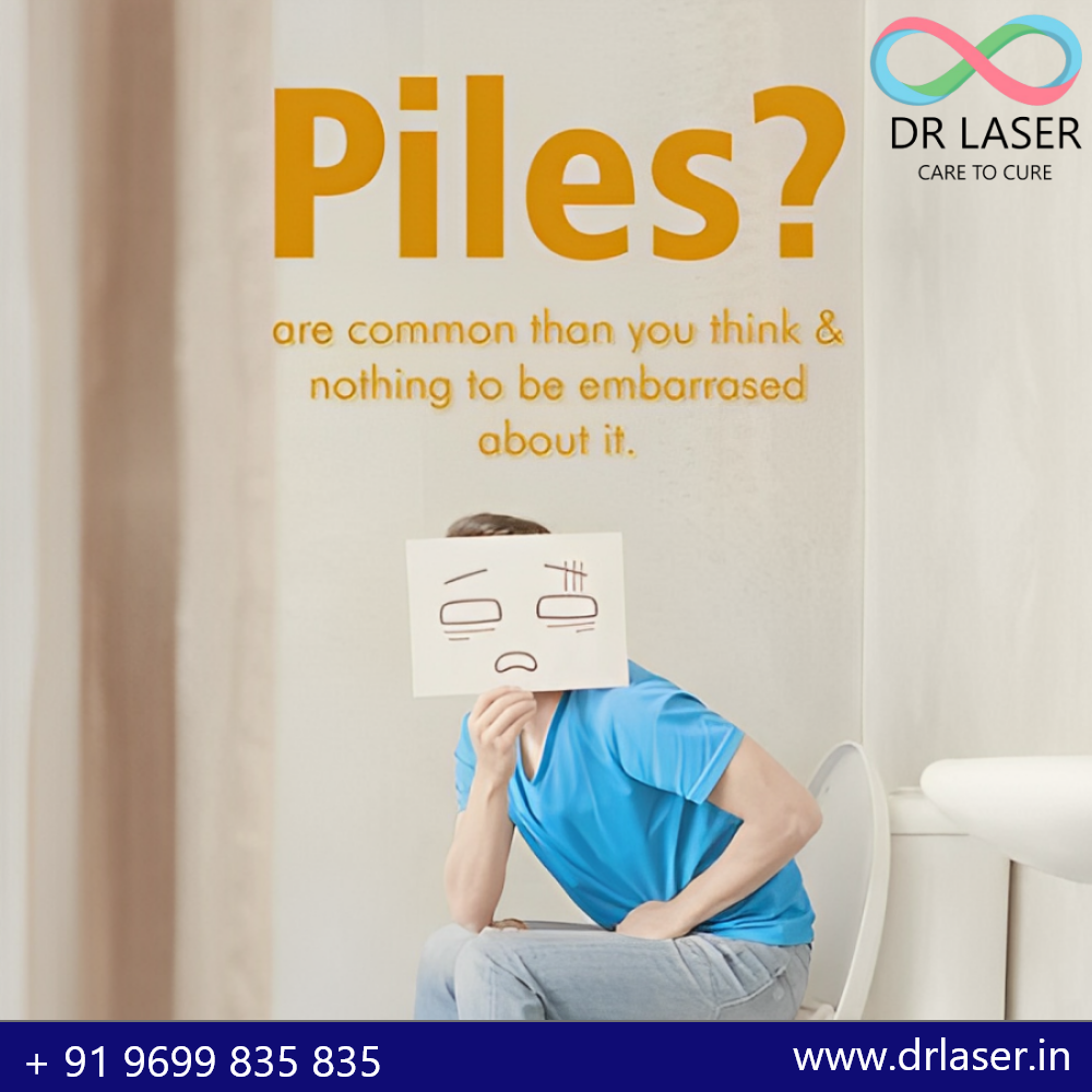 Piles Are More Common Than You Think, and There’s No Need to Feel Embarrassed!