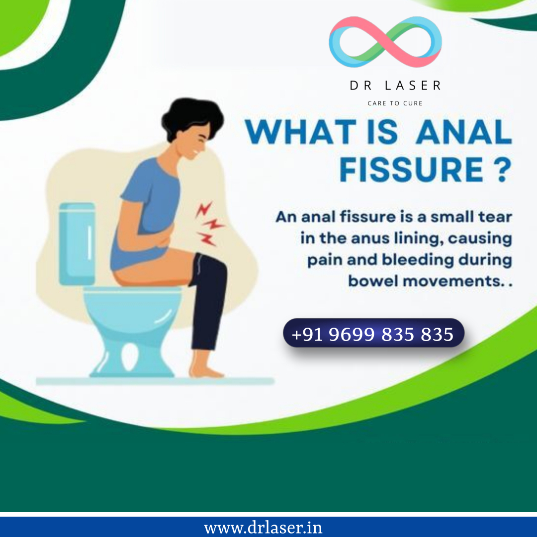 Understanding Anal Fissures