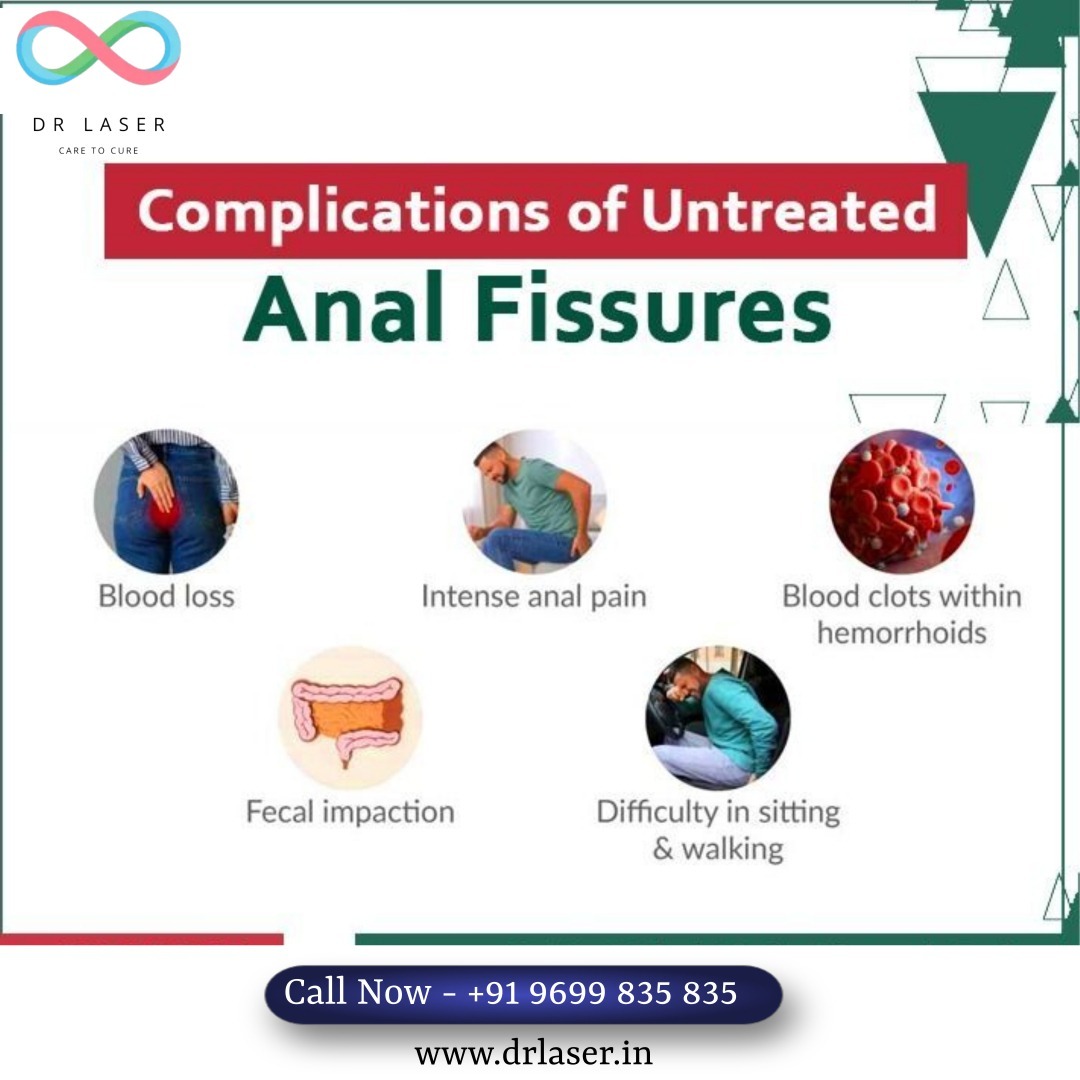 Understanding the Complications of Untreated Anal Fissures with Dr. Laser