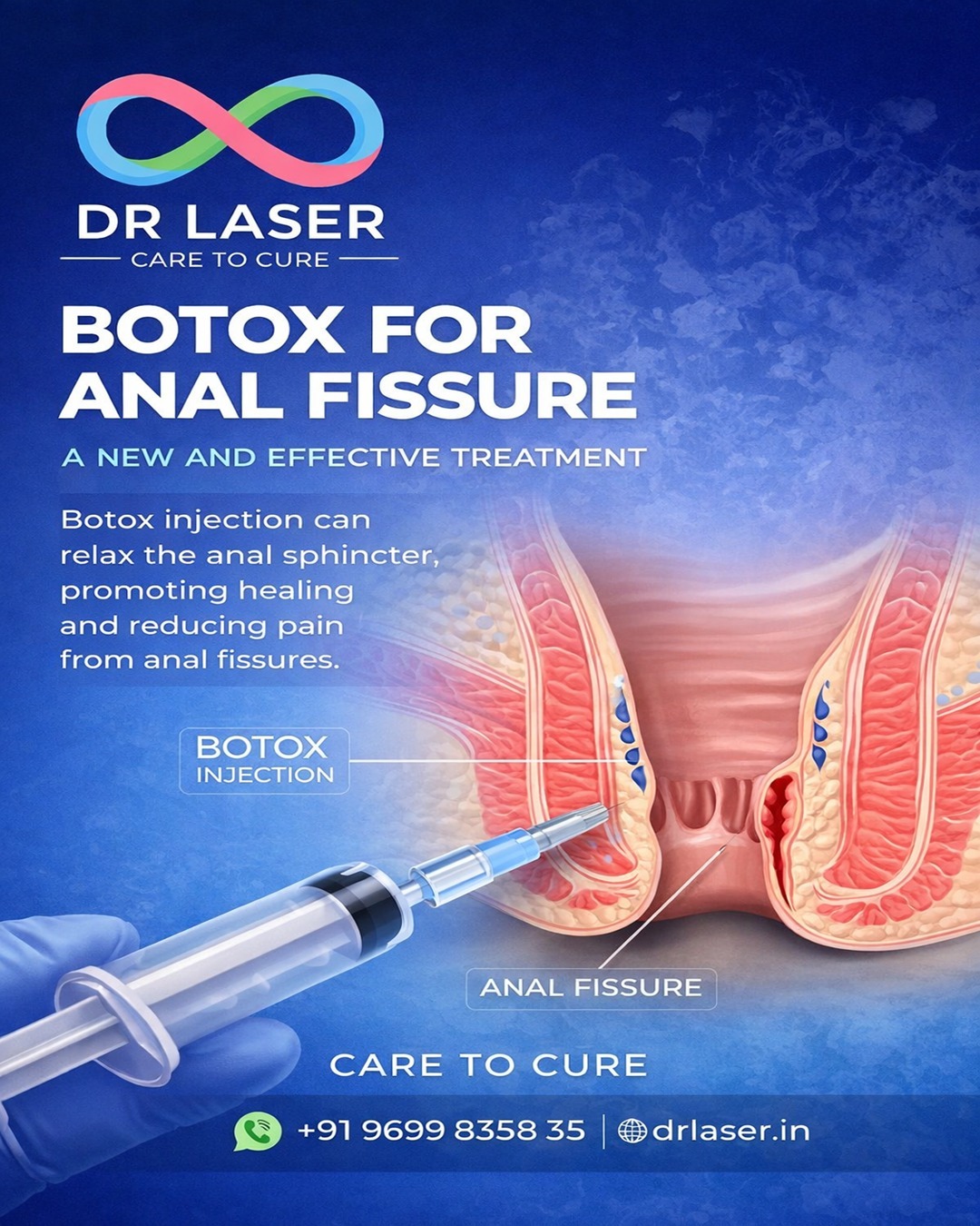 Suffering from anal fissure pain? Modern medical solutions can help you recover comfortably.