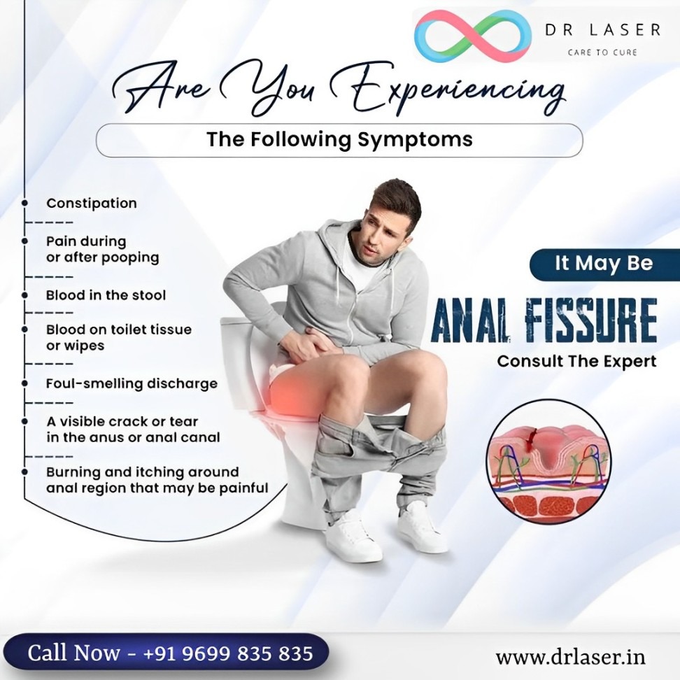 Anal Fissure Symptoms