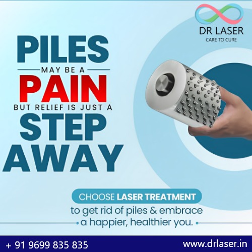 Say Goodbye to Piles with Advanced Laser Treatment