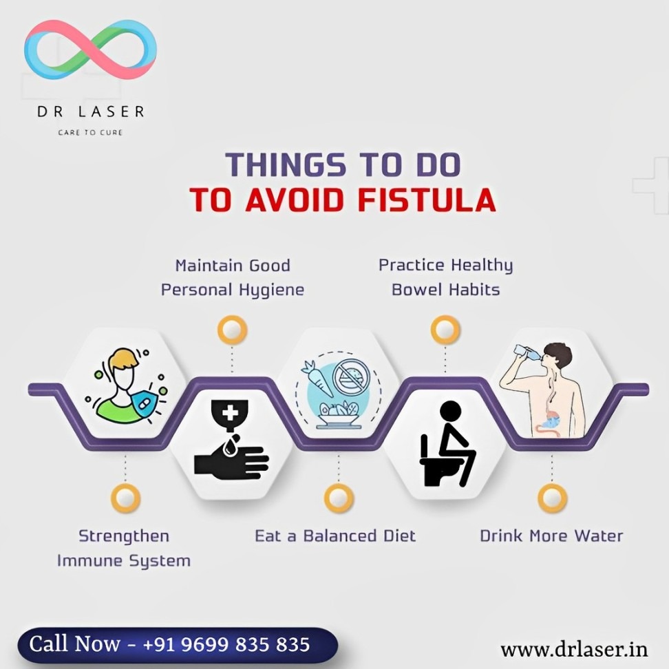 Take proactive steps to avoid fistula