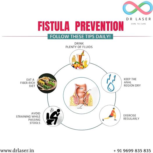 Struggling with Fistula? 