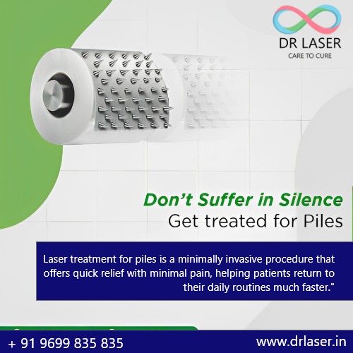 Say Goodbye to Piles with Laser Treatment at DR LASER – Fast, Effective Relief