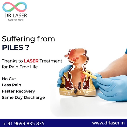 A Pain-Free Solution for Piles: Laser Treatment at Dr Laser Care